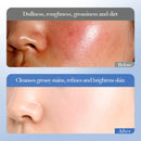 Conjunto de Cuidados Essenciais com a pele VaporOne, soro facial clareador, creme removedor de rugas, encolhe os poros, desbota, melanina opaca, hidrata e ilumina, (6 peças)