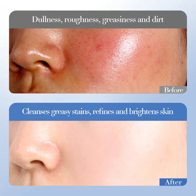 Conjunto de Cuidados Essenciais com a pele VaporOne, soro facial clareador, creme removedor de rugas, encolhe os poros, desbota, melanina opaca, hidrata e ilumina, (6 peças)